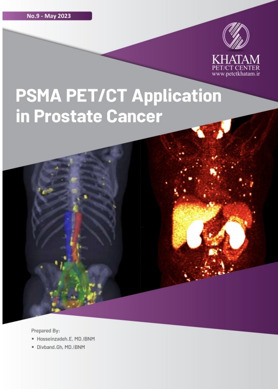 PSMA PET/CT Application in Prostate Cancer, No.9 May 2023